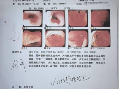 猫咪哮喘——一种无法治愈的呼吸系统疾病（探究猫哮喘和支气管炎的迹象及其关联）