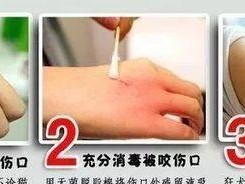 狗咬伤后应该如何清洗伤口？（有效清洁伤口，预防感染）