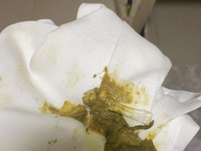 狗狗拉稀的时间周期及原因探究（狗狗饭后多久会出现拉稀症状？拉稀的可能原因有哪些？）