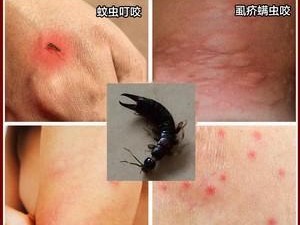 狗狗被蚊子咬了该涂什么药膏？（保护宠物免受蚊虫侵扰的有效药膏和注意事项）